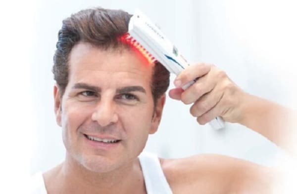 Liệu pháp laser trị rụng tóc